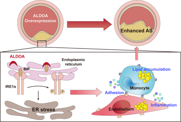 图5ALDOA的过表达加速ApoE-/-小鼠动脉粥样硬化斑块的进展